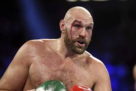 Tyson Fury